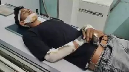 झाझा: भीठरा पेट्रोल पंप के पास सड़क हादसे में बाइक सवार घायल, रेफरल अस्पताल झाझा में हुआ इलाज