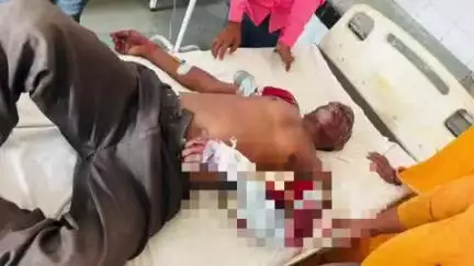 बाह: मंगदपुर के पास सड़क हादसे में वृद्ध गंभीर रूप से घायल