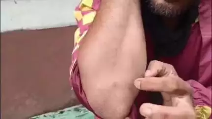 ব্যারাকপুর ২: বেসরকারি ডেলিভারি সংস্থায় কর্মীর উপর ধারালো অস্ত্র নিয়ে হামলার অভিযোগ সোদপুরের ঘটনা