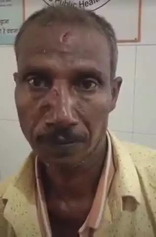 नवाबगंज: रेंदुआ पल्हरी गांव में रिश्तों की सारी हदें पार, नशे में धुत बेटे ने पिता पर किया ईंट से हमला