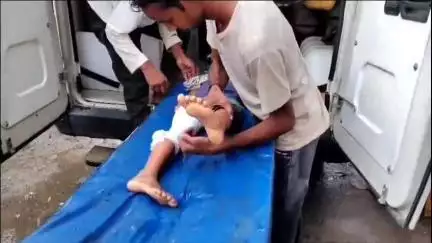 इटावा: इकदिल इलाके में सड़क पार करते समय 5 वर्षीय मासूम को बाइक सवार ने मारी टक्कर, गंभीर हालत में सैफई पीजीआई रेफर किया गया है