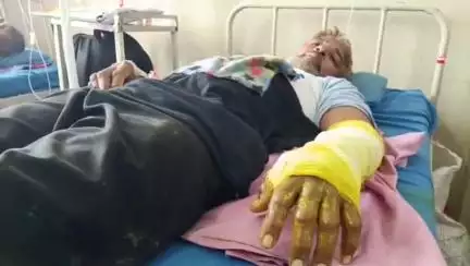 बड़गांव: सांप के काटने पर थैली में सांप लेकर MB हॉस्पिटल पहुंचे जमील, सूझबूझ व हॉस्पिटल स्टाफ की तत्परता से बची जान