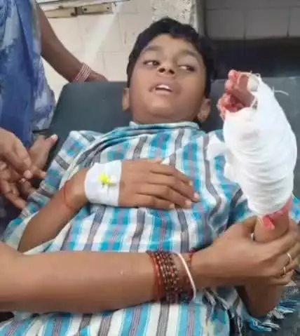 గుంతకల్లు: గుంతకల్ పట్టణంలోని ఎస్ జే పీ హైస్కూల్లో భోజన సమయంలో విద్యార్థుల మధ్య తోపులాట: రామన్న అనే విద్యార్థికి తీవ్ర గాయాలు