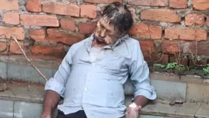 बूंदी: पुरानी धान मंडी में मृत मिले व्यक्ति की पहचान नहीं हो सकी, पुलिस ने सोशल मीडिया पर फोटो डालकर पहचान के प्रयास शुरू किए