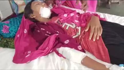 बांसवाड़ा: उटिया पाण गांव में घर से स्कूल जा रही छात्रा को बाइक ने मारी टक्कर, एमजी अस्पताल में उपचार जारी