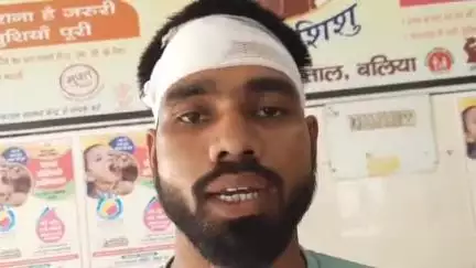 बलिया: बड़ी बलिया दुर्गास्थान के पास दिव्यांग के साथ मारपीट कर फोड़ा गया सिर, पीड़ित ने पुलिस से लगाई गुहार