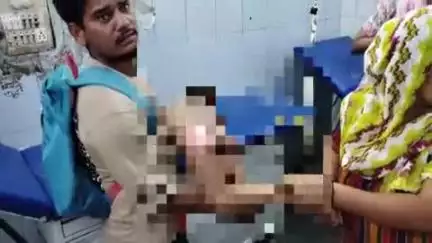 बुलंदशहर: गांव धनोरा शेख में खौलती सब्जी से जली छोटी बच्ची, जिला अस्पताल लाया गया, हायर सेंटर किया गया रेफर