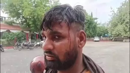 रमना टोला में विवाद के बाद ठेकेदार ने मजदूर को डंडे से मारा, घायल मजदूर ने सिटी कोतवाली में दर्ज कराई रिपोर्ट