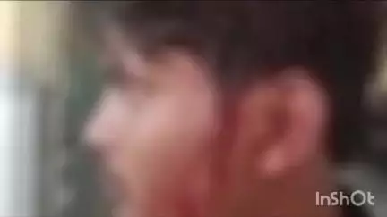 एटा: अलीगंज रोड पर आपसी कहासुनी के चलते बाइक सवार युवकों ने दो सगे भाइयों के साथ की मारपीट