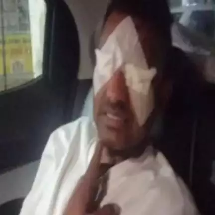 मुंडावर: मोहन बाग के समीप 2 बदमाशों ने HP गैस एजेंसी के मैनेजर की आंखों में मिर्च पाउडर डालकर लूटे ₹1.25 लाख
