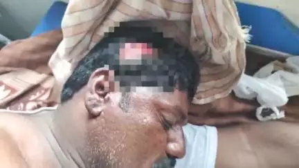 ఆలూరు: ములుగుందం సమీపంలో రెండు బైకులు ఢీ, ముగ్గురికి గాయాలు