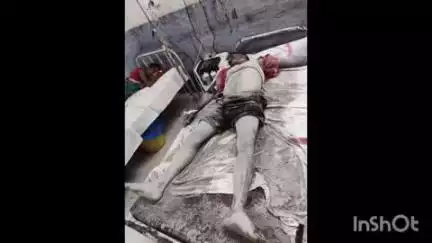 रतनी फरीदपुर: शकुराबाद बाजार में बिजली के करंट से युवक घायल, शकुराबाद अस्पताल में इलाज जारी