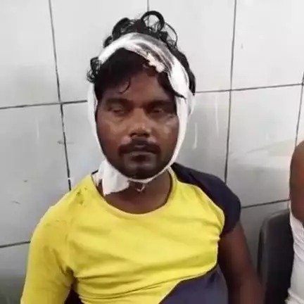 गोपालगंज: चितु टोला गांव में आपसी विवाद में दो पक्षों के बीच मारपीट, एक ही परिवार के तीन लोग घायल