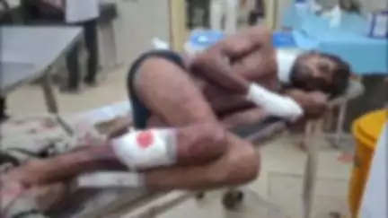 दमोह: इमली जोग में जमीनी विवाद के चलते पिता ने पुत्र पर किया धारदार हसिए से हमला, गंभीर हालत में ज़िला अस्पताल में कराया भर्ती