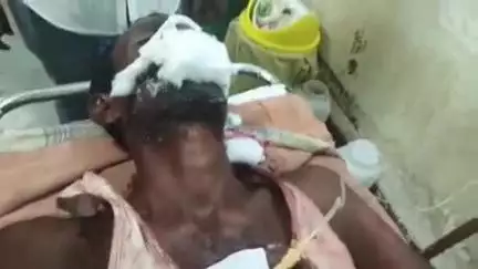 సూర్యాపేట: రావిపాడు లో భూతగాదాల ఘర్షణలో కర్రలతో దాడి ఒకరికి గాయాలు