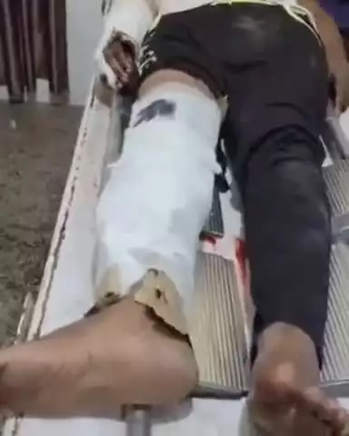 बिल्हौर: बिल्हौर में विपरीत दिशा से आ रहे टेंपो ने बाइक में मारी टक्कर, चालक फरार, पुलिस ने वाहन किया ज़ब्त
