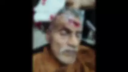 കോഴിക്കോട്: പന്തീരങ്കാവിന് സമീപം തെരുവുനായയുടെ ആക്രമണം, മൂന്നു പേർക്ക് സാരമായി പരിക്കേറ്റു