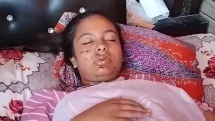 नूह: गांव आटा बरोटा में लड़की के मुंह पर शराब की बोतल से हमला, 2 लोगों पर मामला दर्ज