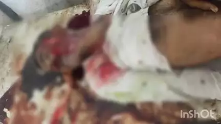 माण्डल: कालूखेड़ा चौराहे के पास मिला अधेड़ का खून से सना शव, शिनाख्त नहीं हुई, पास में मिली बैसाखी