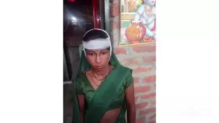 जलालाबाद: ग्राम चरनोक में दबंगों ने घर में घुसकर तकोला एवं लाठी-डंडों से किया हमला, चार लोग घायल, आरोपियों पर नहीं हुई कार्रवाई