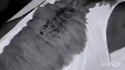 रामसनेही घाट: फतेहगंज गांव में पुरानी रंजिश के चलते 2 पक्षों में हुई मारपीट, 4 लोग हुए घायल