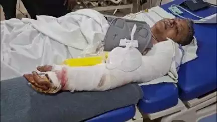 सर्किट हाउस के समीप बस ने स्कूटी में मारी टक्कर, रिटायर्ड डॉक्टर को आई गंभीर चोट