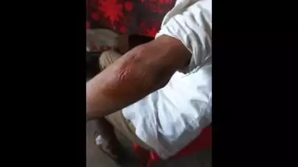 বসিরহাট ২: জাফরপুরে মটর ভ্যান থেকে পড়ে গিয়ে গুরুতর অবস্থায় ধান্যকুড়িয়া গ্রামীণ হাসপাতালে ভর্তি ১ ব্যাক্তি