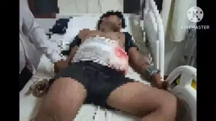 खुरई: रजवास रोड पर ढाबे में नमक की डिब्बी उठाने पर विवाद, युवक ने दूसरे को मारा चाकू