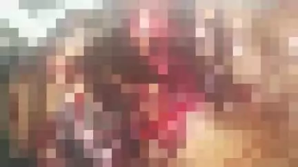 नौगावां सादात: नौगांवा बीलना नहर के पास अज्ञात वाहन की टक्कर से बाइक सवार हुआ घायल, हालत गंभीर