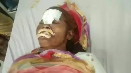भीलवाड़ा: बीगोद के समीप कार ने बाइक को मारी टक्कर, बाइक पर सवार मां-बेटे हुए घायल, जिला अस्पताल कराया भर्ती
