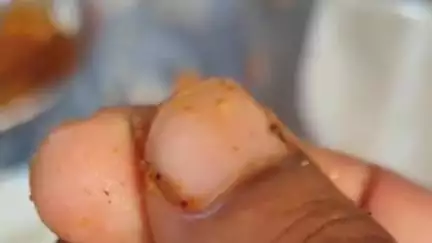 കൊട്ടാരക്കര: ഹോട്ടലിൽ നിന്ന് വാങ്ങിയ ബിരിയാണിയിൽ കുപ്പിച്ചില്ല്, ചിതറയിൽ തൊണ്ട മുറിഞ്ഞയാൾ ചികിത്സ തേടി
