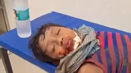 जगदीशपुर: पक्का मकान की छत से गिरने पर 10 वर्षीय प्रिंस कुमार बुरी तरह जख्मी, मायागंज अस्पताल में भर्ती