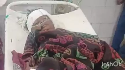 अनूपपुर: बंदर के हमले से बालक घायल, ज़िला चिकित्सालय में उपचार के लिए भर्ती
