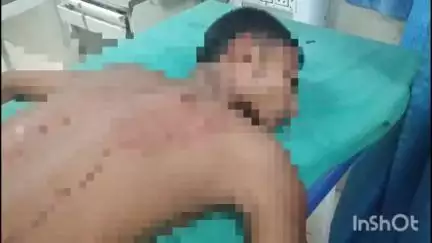 अररिया: बेलवा में दो पक्षों के बीच आपसी विवाद के दौरान एक किशोर को चाकू मारकर किया घायल, इलाज जारी