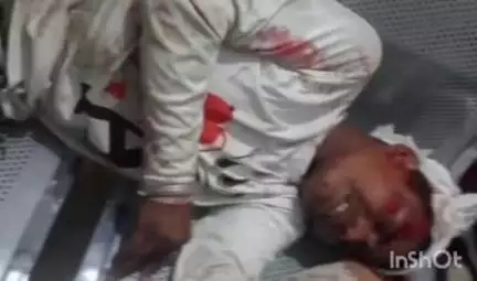 चतरा: गांधरिया स्कूल के पास सवारी वाहन के कारण बाइक दुर्घटना, एक युवक घायल, इलाज जारी