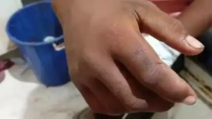मिश्रिख: भैसासुर गांव में जहरीले सांप के काटने से किशोर की हालत बिगड़ी, अस्पताल में कराया गया भर्ती