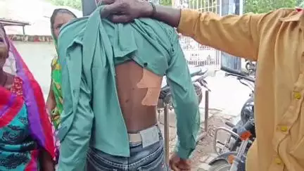 एटा: गांव दिउना कला में दलित युवक के साथ आरोपियों ने ईंट और डंडों से मारपीट कर गंभीर घायल किया, एसएसपी कार्यालय में की शिकायत