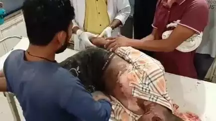 मिश्रिख: किनॉटि मढ़िया में घर की छत पर फोन पर बात करते समय युवक अचानक बिजली के करंट की चपेट में आकर बुरी तरह झुलसा