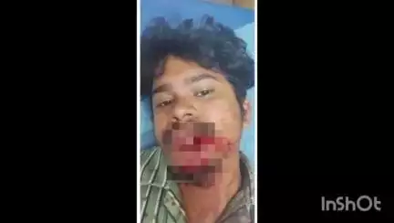 పెందుర్తి: సింహాచలంలో ఇంటి దారి విషయమై లో గొడవపడి యువకుడు పై కత్తితో దాడి చేసినమరోయువకుడు కేసునమోదు చేసి రిమాండ్ కితరలించినపోలీసులు