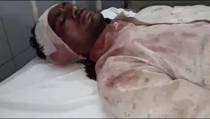 बांसवाड़ा: वगेरी चरपोटा गांव में शराब के नशे में भतीजे ने चाचा के सिर पर धारदार हथियार से हमला किया, एमजी अस्पताल में उपचार जारी