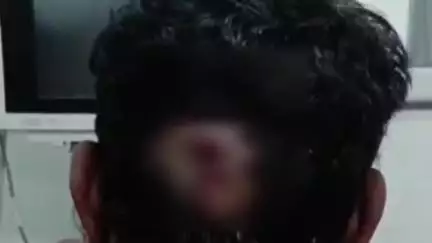 सहजनवा: नौसड़ इलाके के हरदिया गांव के पास दुकान से घर लौट रहे युवक को गोली मारने वाले 2 आरोपियों को पुलिस ने किया गिरफ्तार