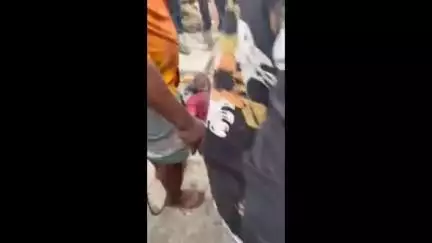 தண்டையார்பேட்டை: புதுவண்ணாரப்பேட்டை பகுதியில் கால்வாய் பணிக்கு ட்ரில்லிங் மெஷின் ஓட்டை போட்ட போது  மின்சாரம் தாக்கி கூலி தொழிலாளிகள் படுகாயம் மருத்துவமனையில் அனுமதி