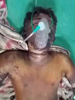 ధర్మవరంలో గురువారం ఒంటిపై పెట్రోల్ పోసుకొని నిప్పంటించుకున్న పట్టుచీరల వ్యాపారస్తుడు.