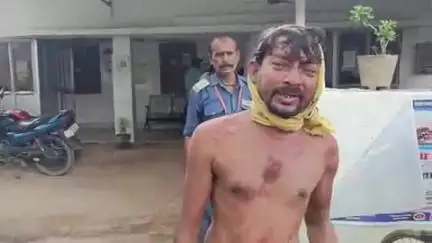 घोसी: घोसी बाजार में आपसी विवाद को लेकर हुई मारपीट, युवक जख्मी
