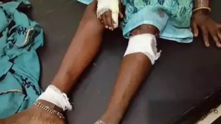 ढीमरखेड़ा: उमरिया के पास ऑटो का ब्रेक फेल होने से 64 वर्षीय महिला ऑटो से गिरी, हुई घायल