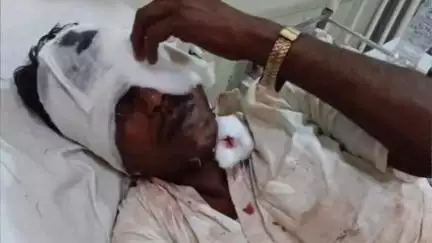 लूनकरनसर: महाजन रेलवे स्टेशन के समीप असम गुवाहाटी ट्रेन से गिरा युवक, गंभीर रूप से हुआ घायल