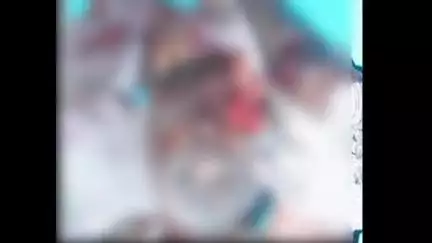नागपूर ग्रामीण: वाडी पोलीस ठाण्याजवळ क्रेनची वृद्धाला धडक, उपचारादरम्यान मृत्यू
