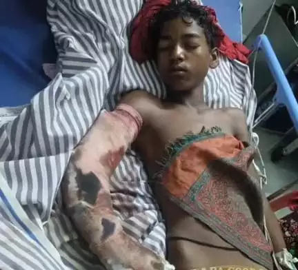 बेलदौर: पश्चिम पार कैंजरी गांव में थ्रेशर से किशोर का हाथ जख्मी, बेलदौर थाने में शिकायत दर्ज