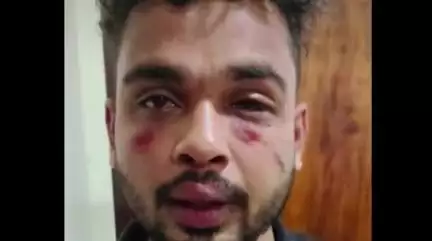 इंदौर: इंदौर के होटल में हिन्दू युवती के साथ मुस्लिम युवक मिला, नाम बदलकर कमरा बुक किया, लव जिहाद गिरोह से जुड़े होने का शक