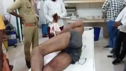 सीतापुर: चपुरवा ग्राम पंचायत में पारिवारिक विवाद के चलते दो पक्षों में मारपीट, तीन लोग घायल, पुलिस ने कराया भर्ती